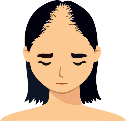 Stage 2