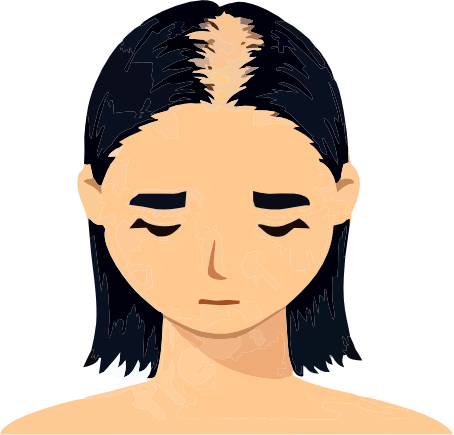Stage 3