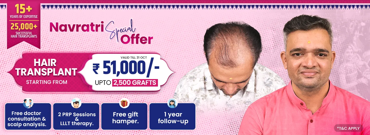 Navratri Special Hair Transplant Offer