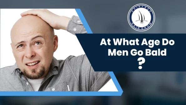 At What Age Do Men Go Bald