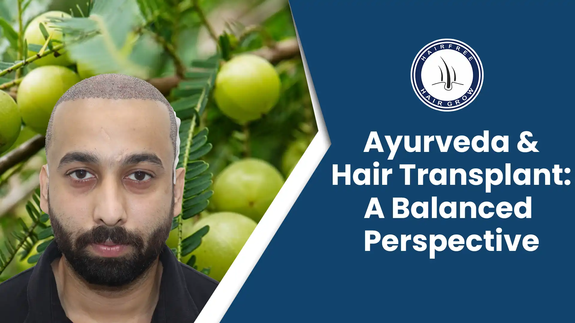 Experience the benefits of Ayurvedic Hair Transplant for healthy regrowth