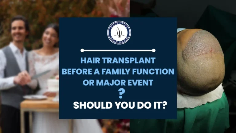Is a Hair Transplant before a Family Function the right choice for you