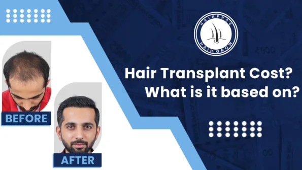 Before and after results of hair transplant surgery showing cost factors