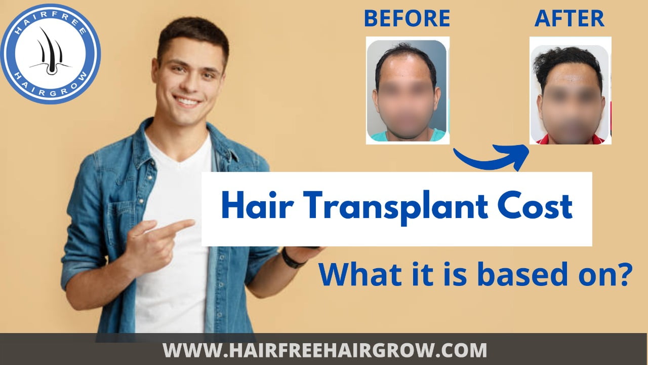 a young man promoting hair transplant cost and showing before and after of male hair transplant done at HFHG Clinic