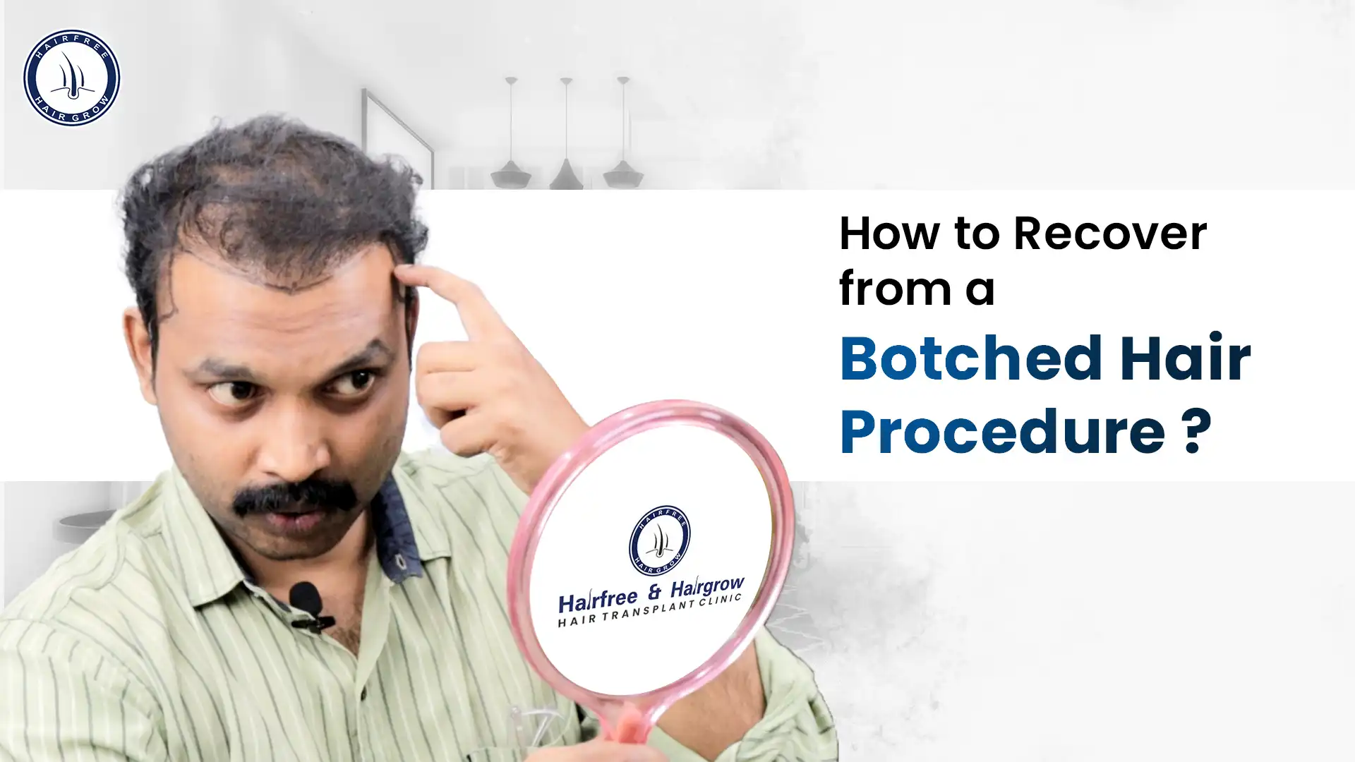 Recovery tips for a botched hair transplant.