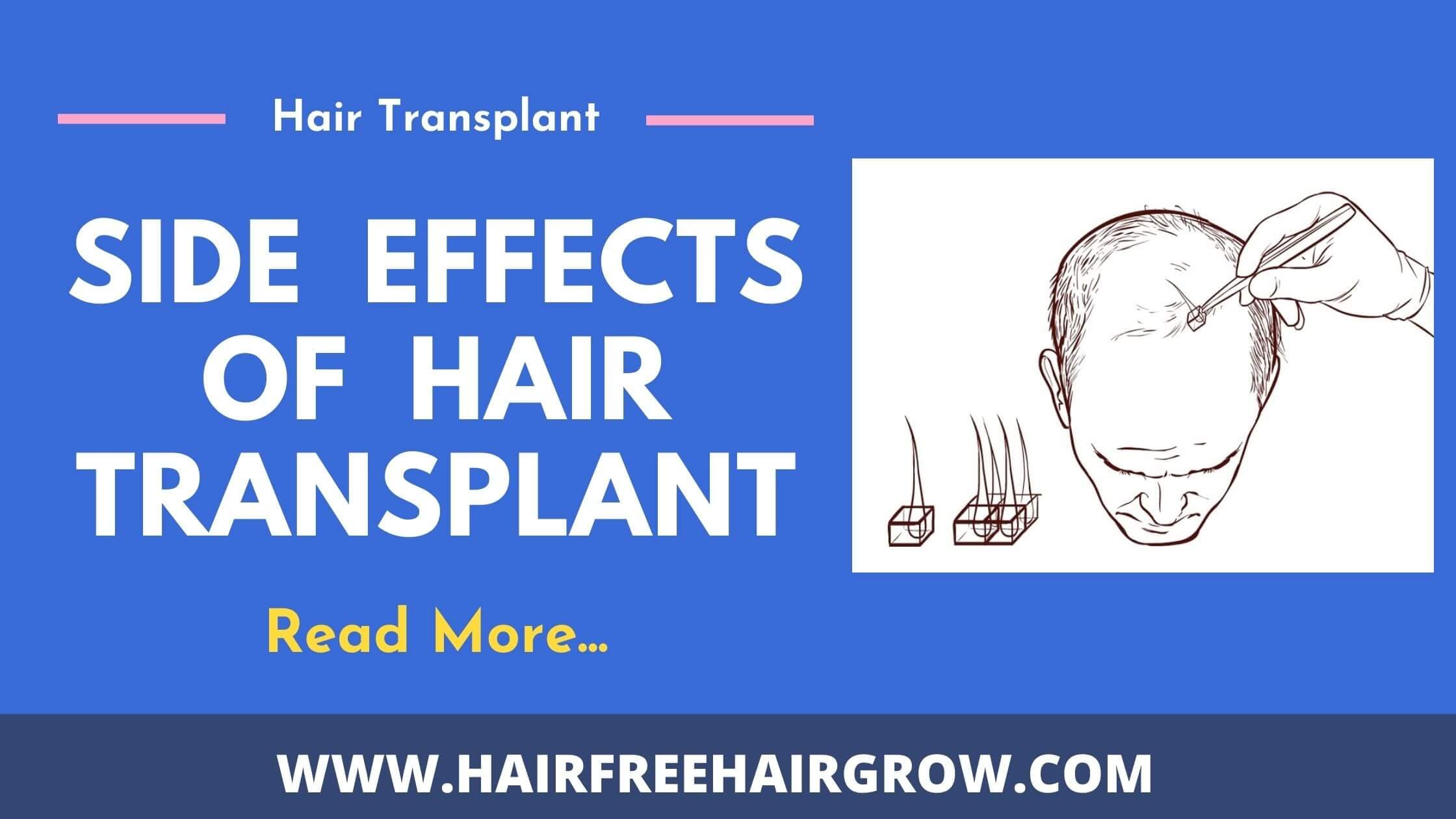 a graphical presentation of how hair transplant procedure is done and side effects of hair transplant