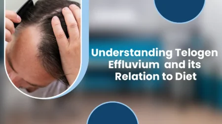 Telogen Effluvium Diet Foods for Healthy Hair Recovery