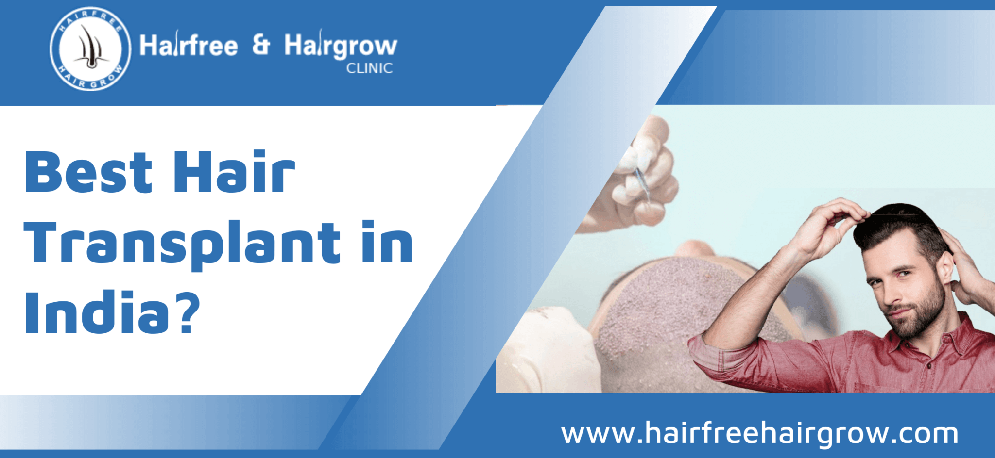 Best Hair Transplant in India? What are the results? - HairFree & HairGrow