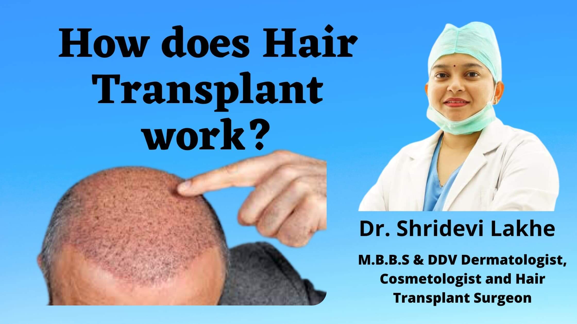 dr shridevi lakhe a best hair transplant doctor explaining how hair transplant works