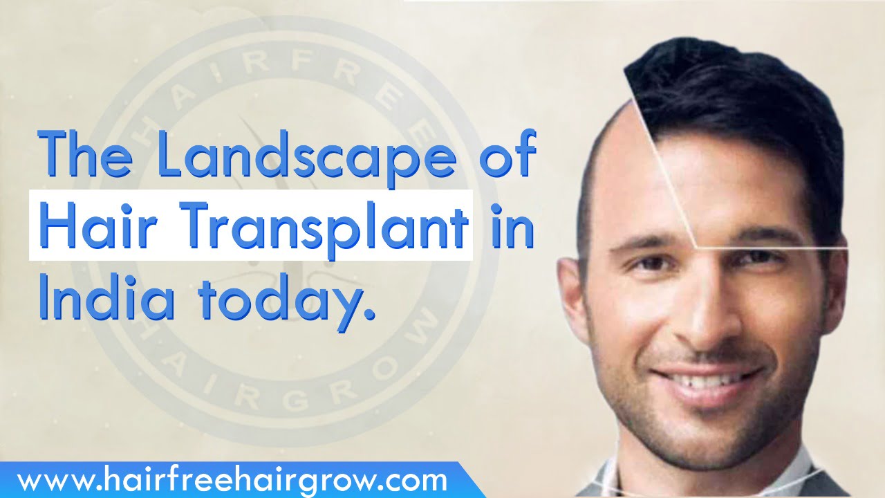 a foreigner happy male with before and after photo of his hair transplant in india treatment done at HFHG clinic