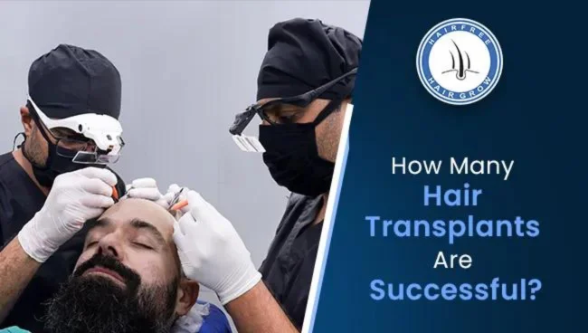 surgeons doing successful hair transplant on a hollywood celebrity