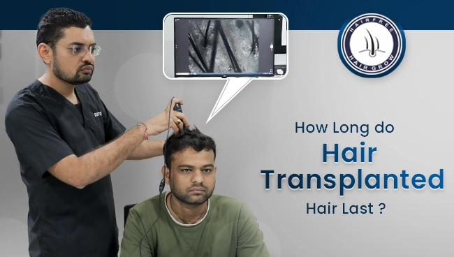 dr jinkal examining patient for hair transplant issue to answer the issue that for how long do the hair transplant last