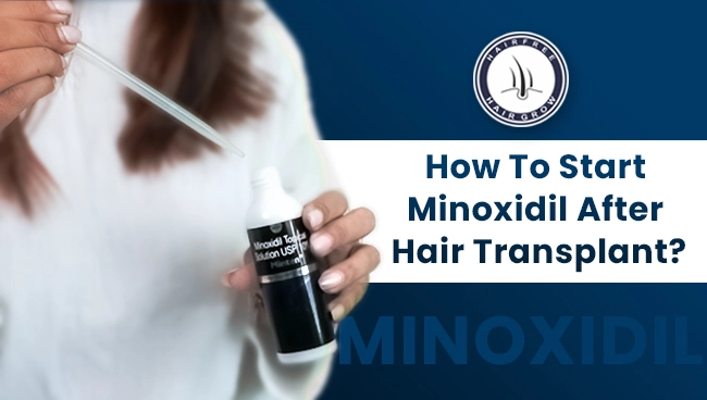 a women holding minoxidil solution bottle for her hair transplant with banner saying how to start minoxidil after hair transplant
