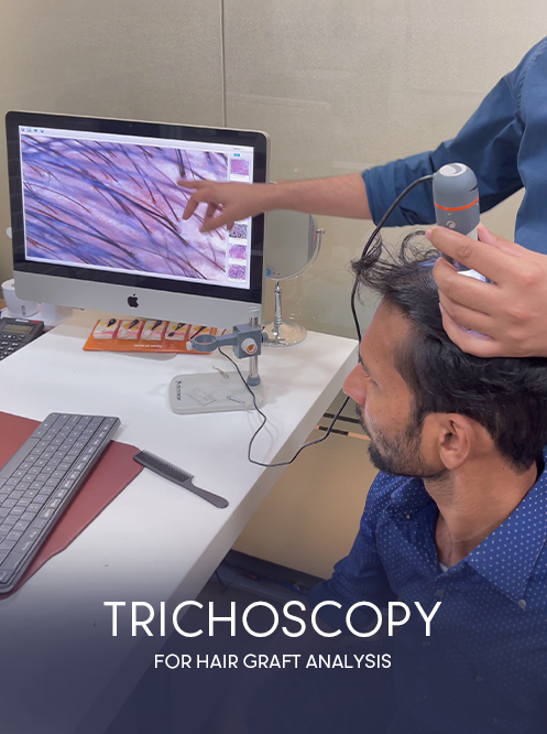 2. trichoscopy