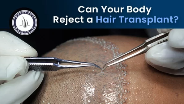doctor performing hair transplant surgery ensuring body don't reject hair transplant