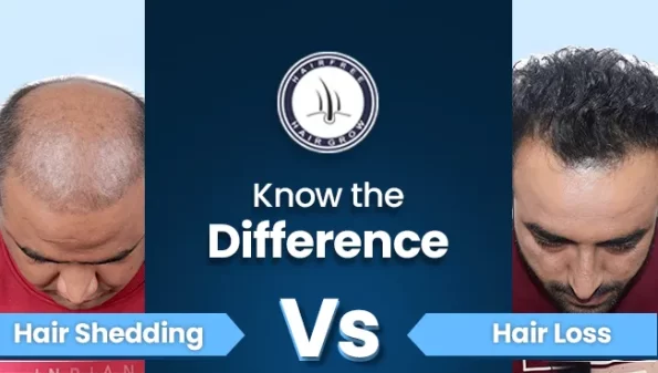 comparative guide on Hair Shedding vs Hair Loss