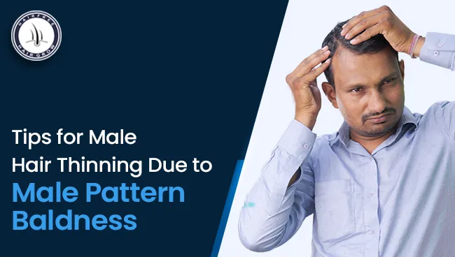 worried man with male hair thinning problem and want to get solution for male pattern baldness