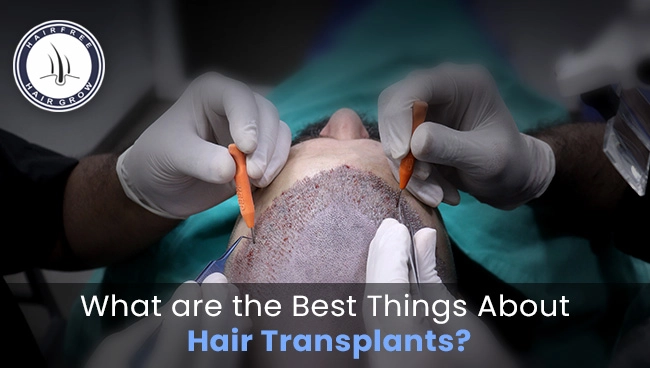 two surgeons performing hair transplant on a patient to explain best things about hair transplant surgeries.