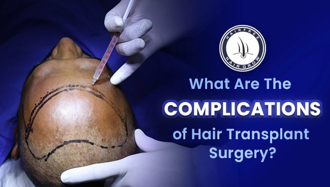 doctor precisely performing hair transplant to avoid complications after hair transplant