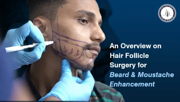 Beard and Moustache Enhancement for a fuller, defined look
