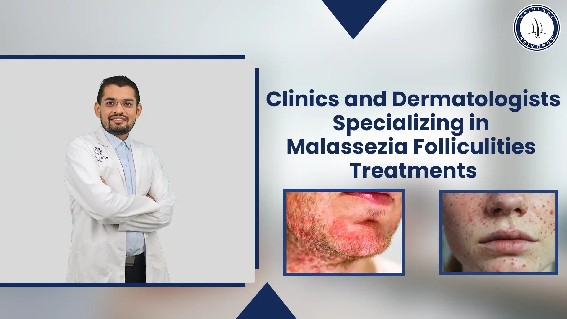 Effective Malassezia Folliculitis Treatment for Clear Skin