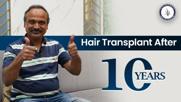 Overview of results for Hair Transplant After 10 Years