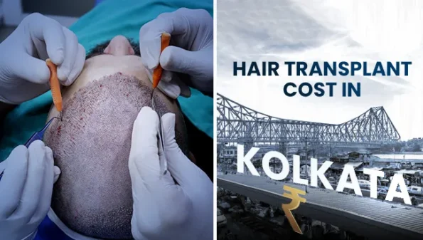 Hair Transplant Cost in Kolkata across different clinics and techniques