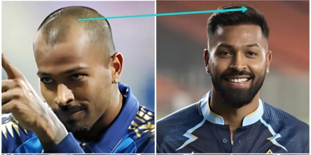 World's Top Cricketers With Hair Transplant - A Hair Case Study