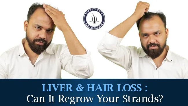 Liver and Hair Loss: Can It Regrow Your Strands