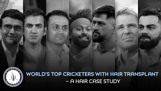 Highlighting Cricketers With Hair Transplant transformations and results