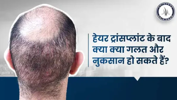 हेयर ट्रांसप्लांट के बाद क्या क्या गलत और नुकसान हो सकते हैं