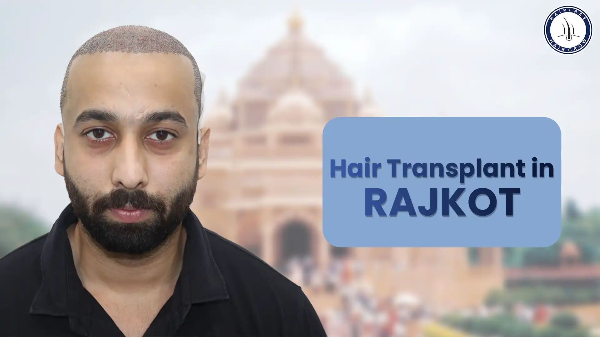 Experienced Hair Transplant in Rajkot for Natural Results