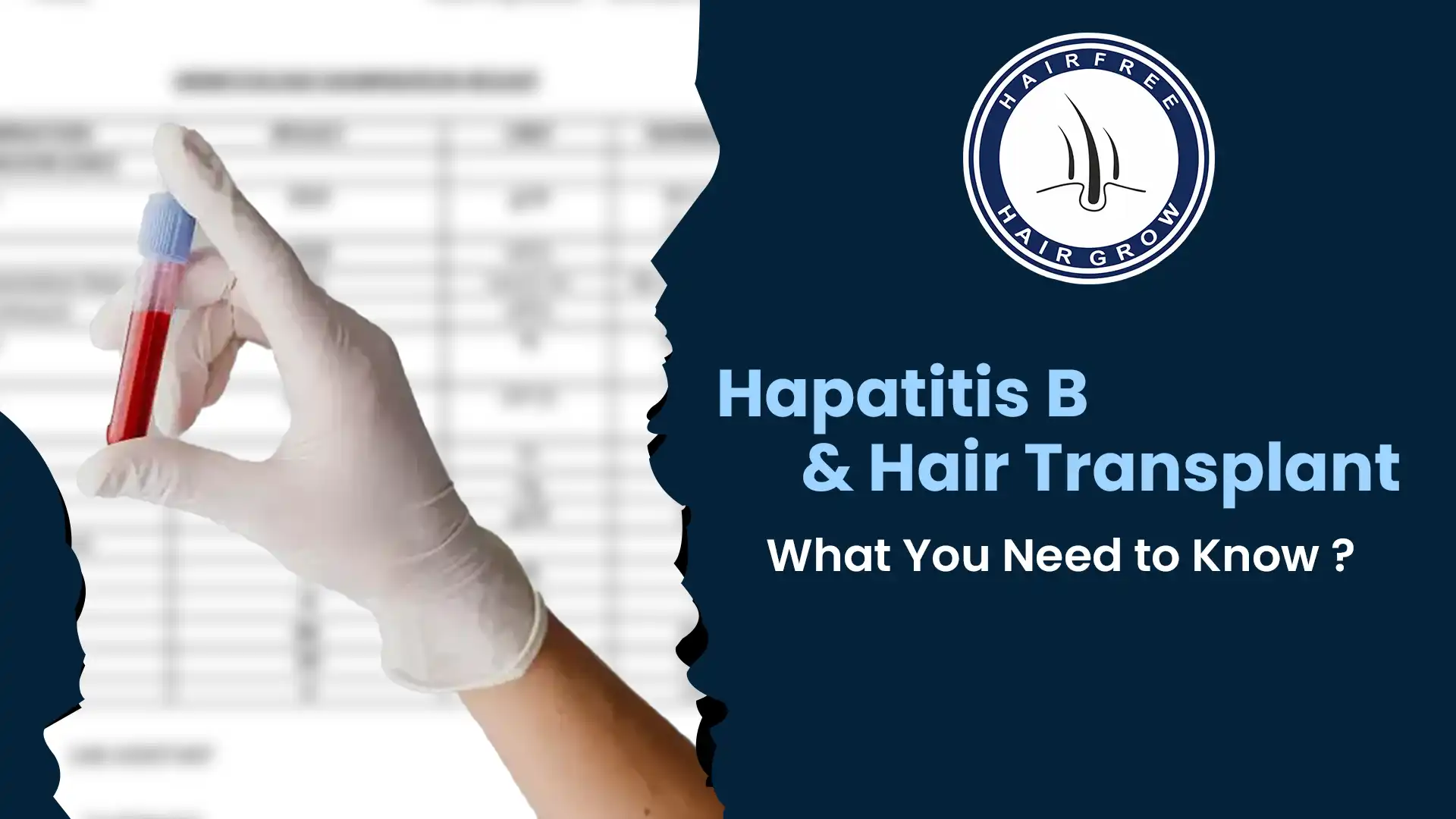 Safe Hepatitis B and Hair Transplant Options