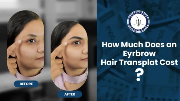 Eyebrow Hair Transplant Cost details and benefits