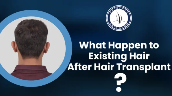 Effect of Existing Hair After Hair Transplant Process