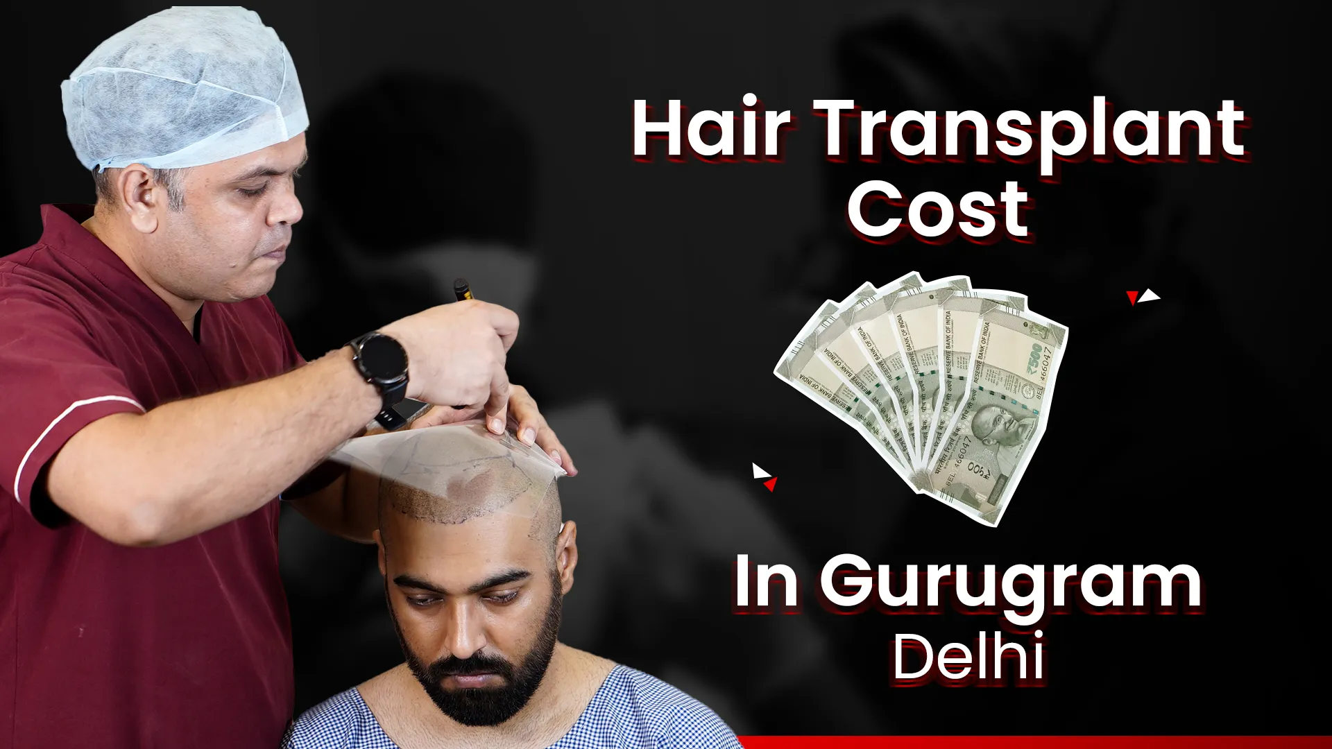 Hair Transplant Cost In Gurugram