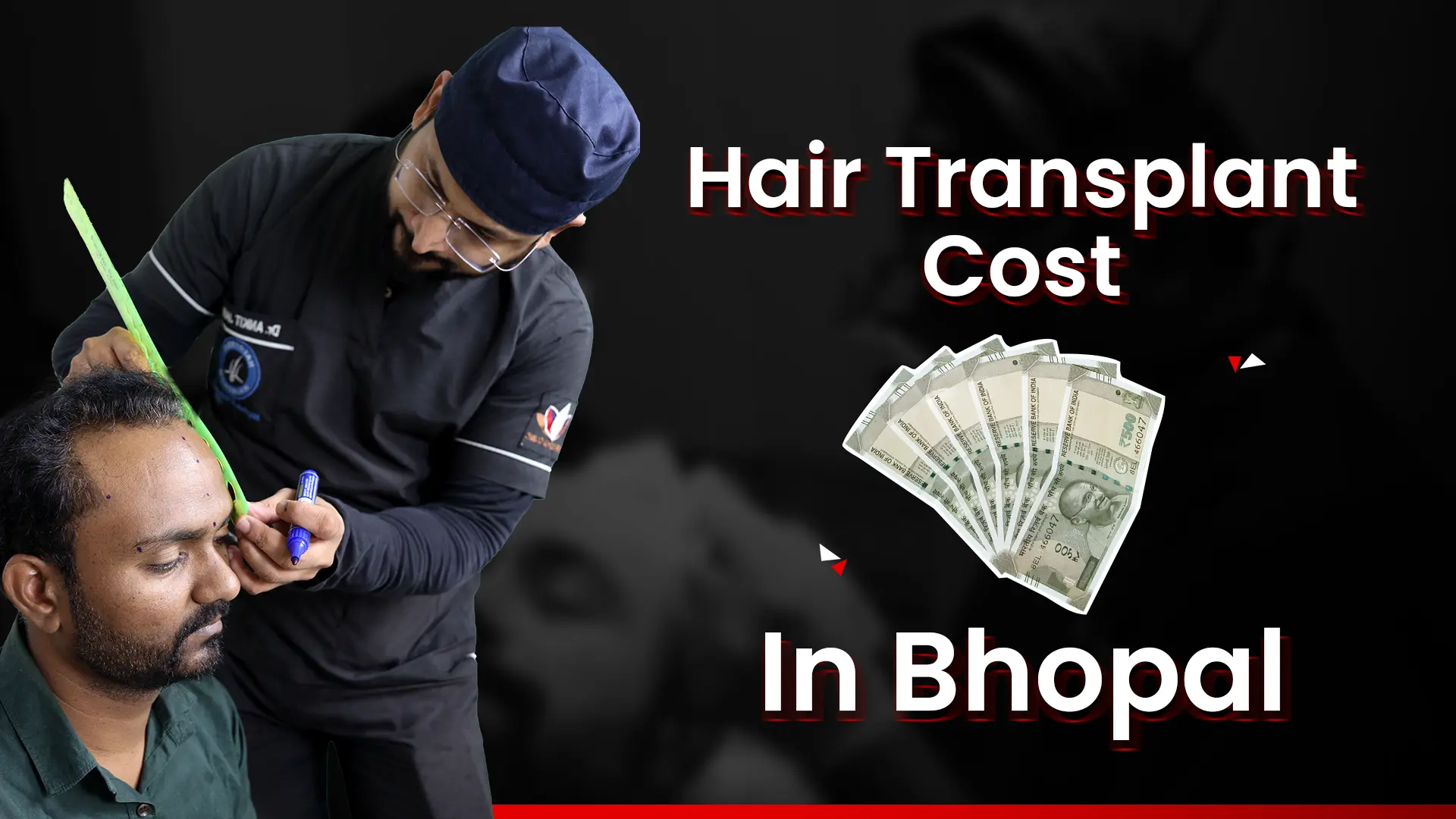 Hair Transplant Cost in bhopal