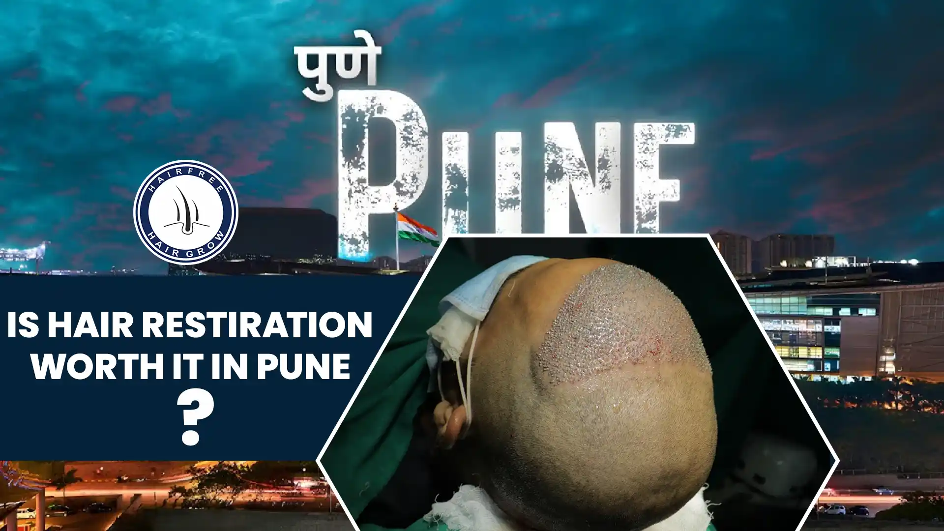 Is Hair Restoration Worth It in Pune? Benefits and Value Explained