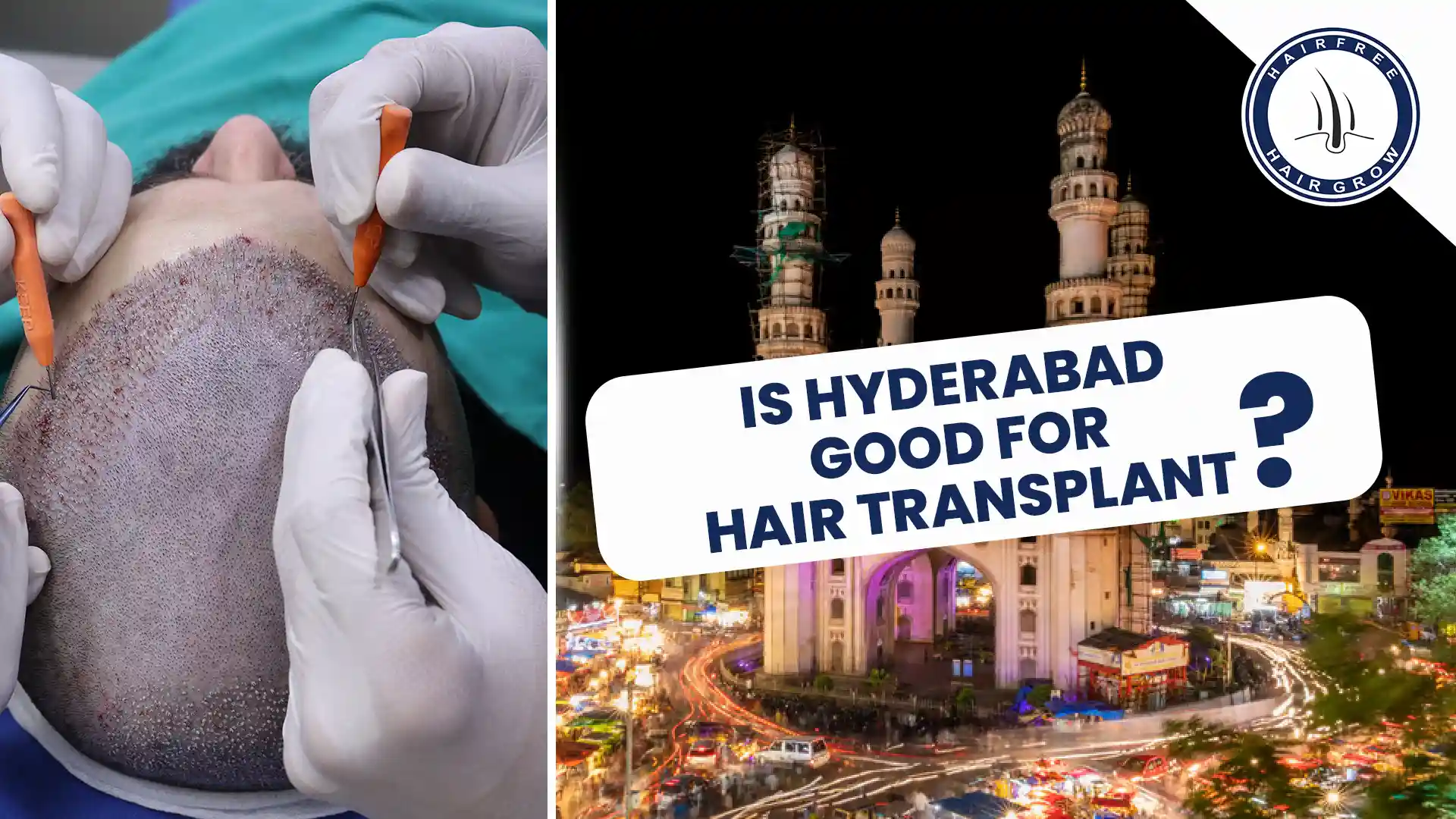 Is Hyderabad Good For Hair Transplant? Discover expert care