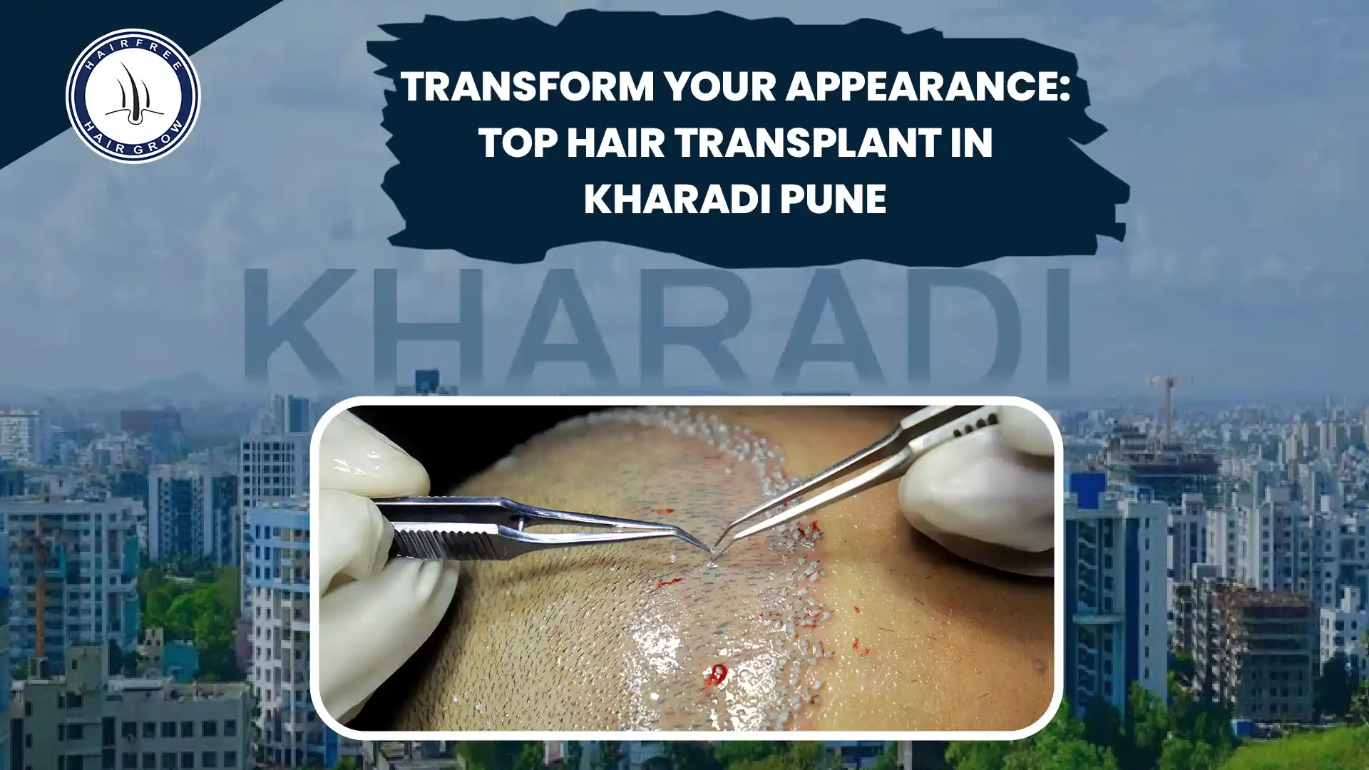 Look with Top Hair Transplant in Kharadi Pune