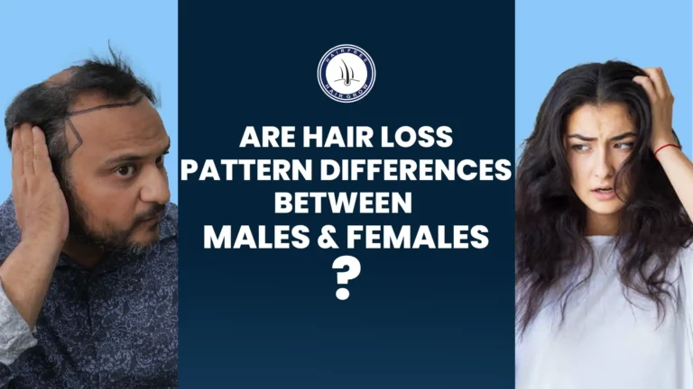 A man and woman showing Hair Loss Pattern differences, highlighting male and female hair loss