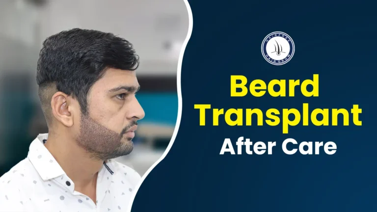 Man with fresh beard growth. Beard transplant aftercare tips