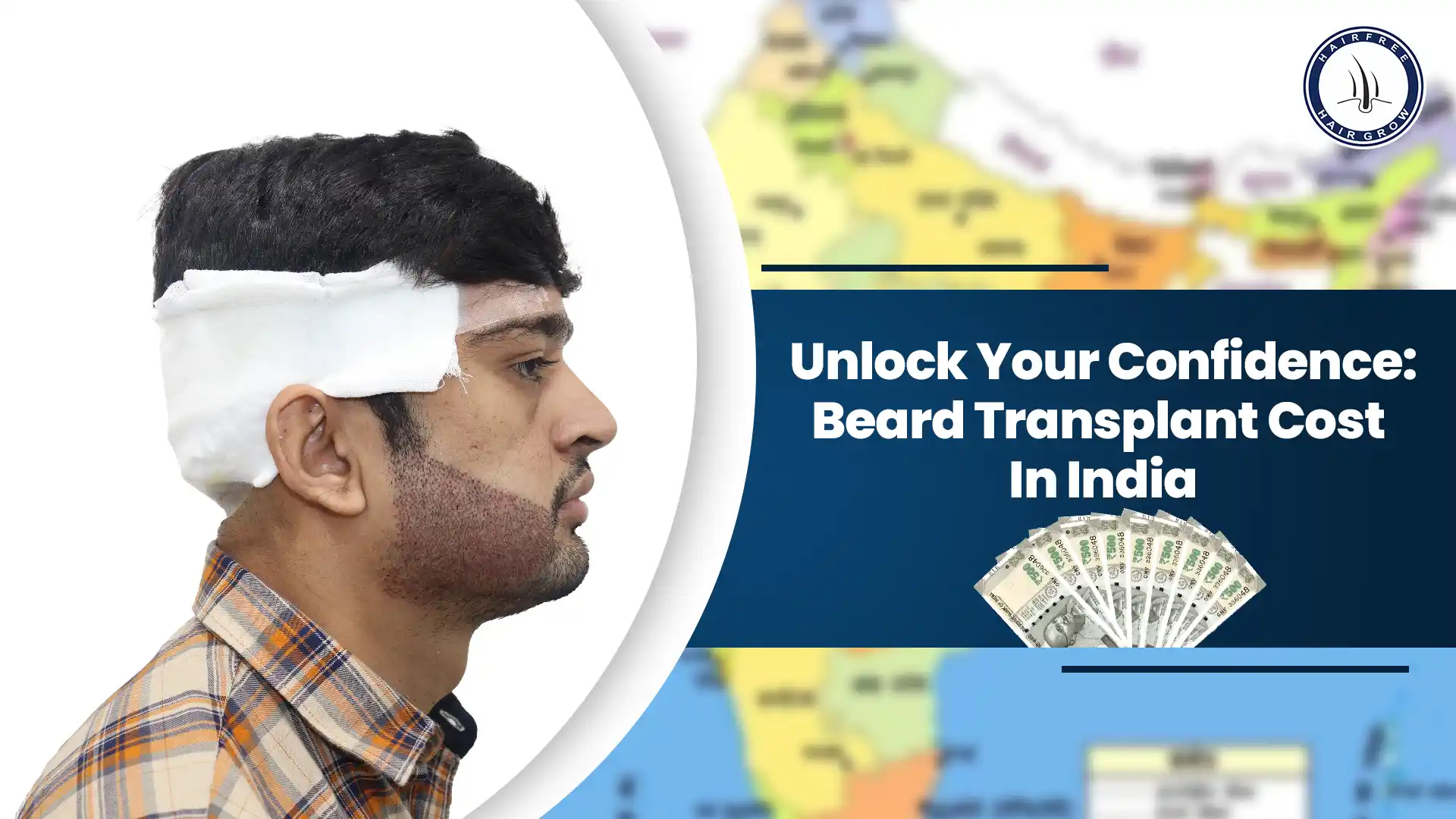 Beard Transplants Cost in India varies based on clinic, technique, and grafts needed.