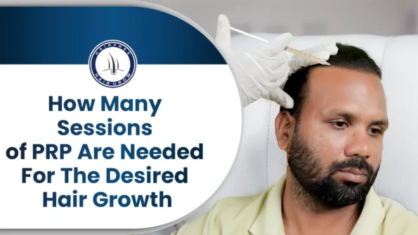 PRP hair treatment session showing how many PRP sessions are needed for hair