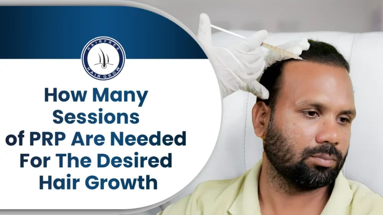 PRP hair treatment session showing how many PRP sessions are needed for hair