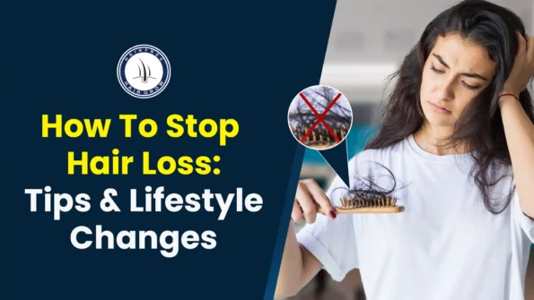 Woman with hair fall holding a brush. How to stop hair loss easily