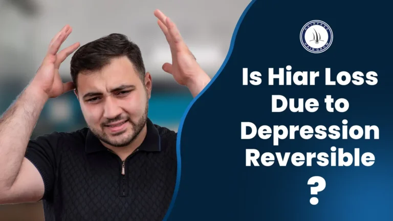 Man worried about hair loss, representing the topic of Depression Hair Loss