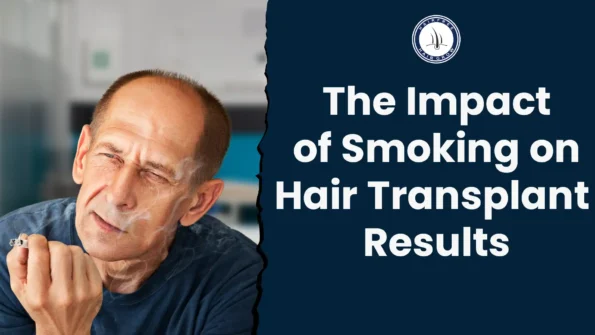 Bald man smoking. Hair transplant smoking effects
