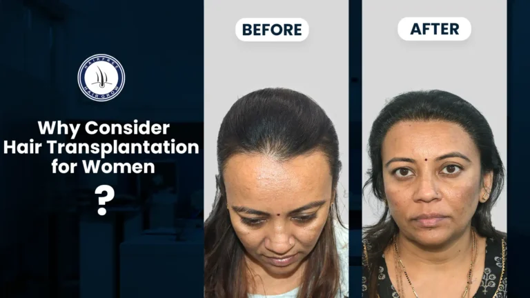 Before and after results of Hair Transplant for Women, showing improved hairline and thicker hair