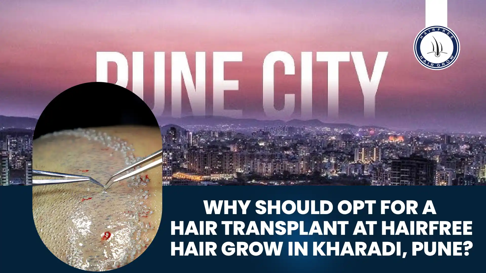 Why Choose HairFree HairGrow Kharadi Pune Hair Transplant: Trusted Expertise and Results